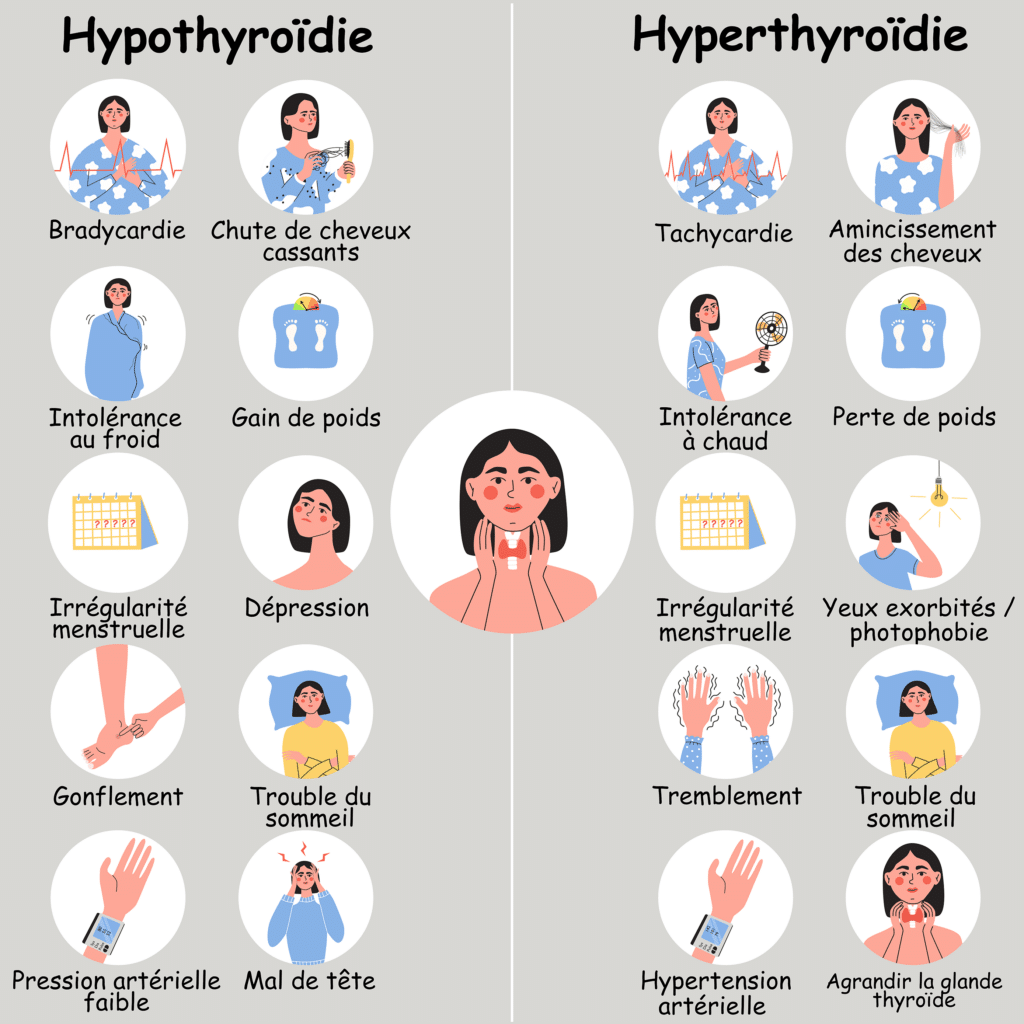 Hypothyroidie VS hyperthyroidie – Crédit : informationhospitaliere.com
