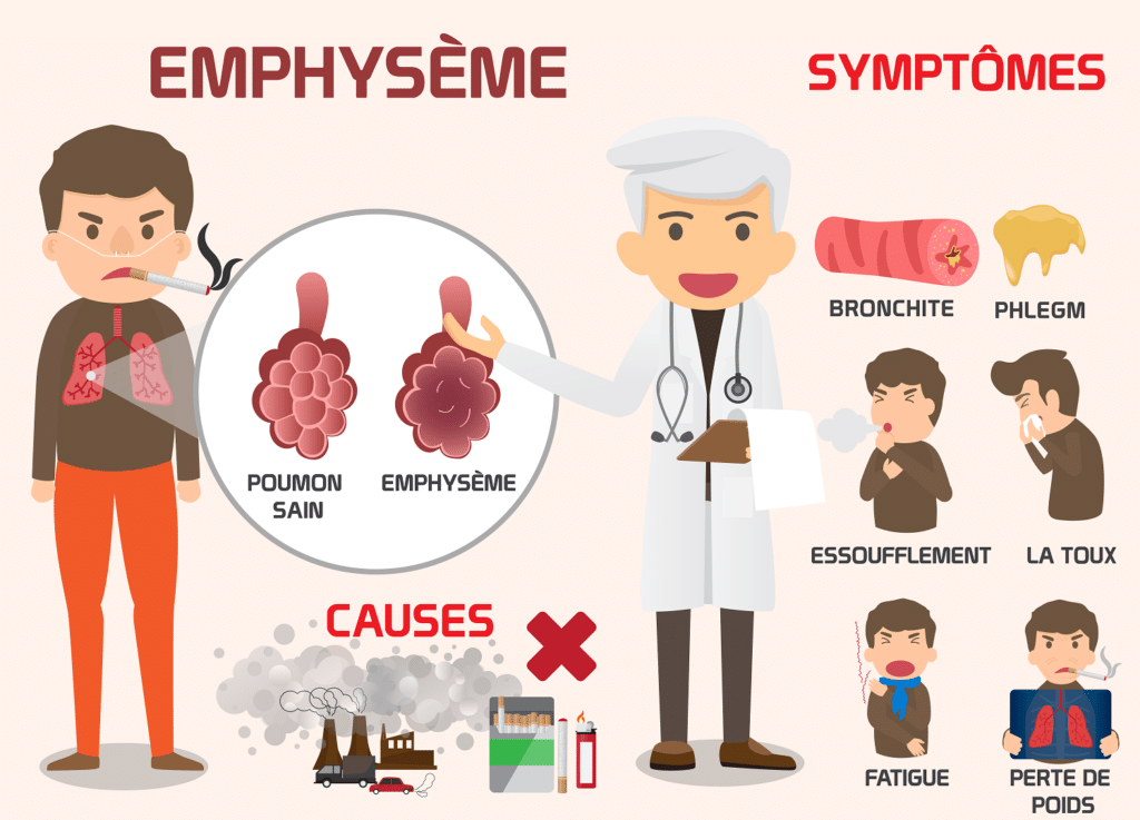 Quelques symptômes de l'emphysème L'emphysème et les BPCO  – © Crédit : informationhospitaliere.com