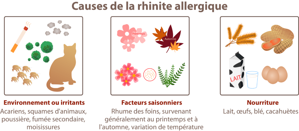 Causes principales de la rhinite allergique - Crédit : informationhospitaliere.com